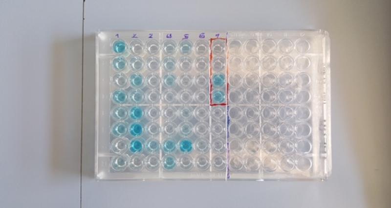 Rinotraqueitis Infecciosa Bovina ELISA