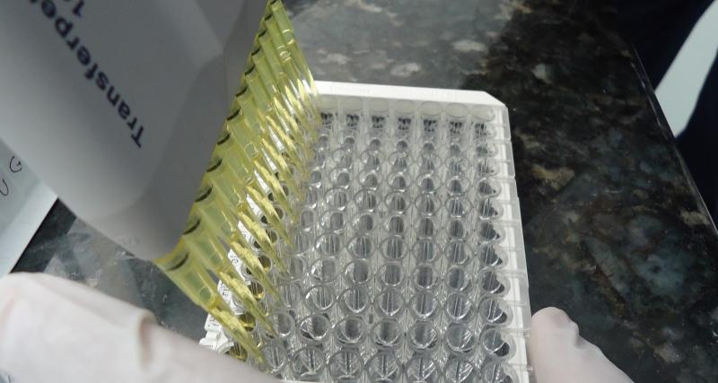 Prueba elisa indirecto