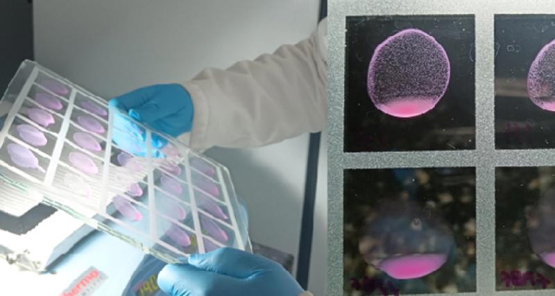 Prueba Rosa de Bengala