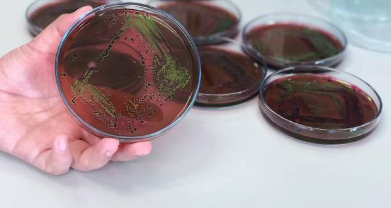 Enterobacterias cultivo