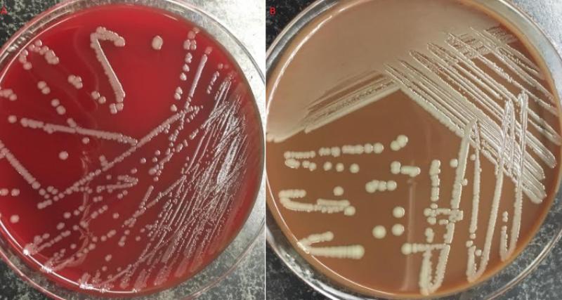 Septicemia Hemorrágica cultivo 