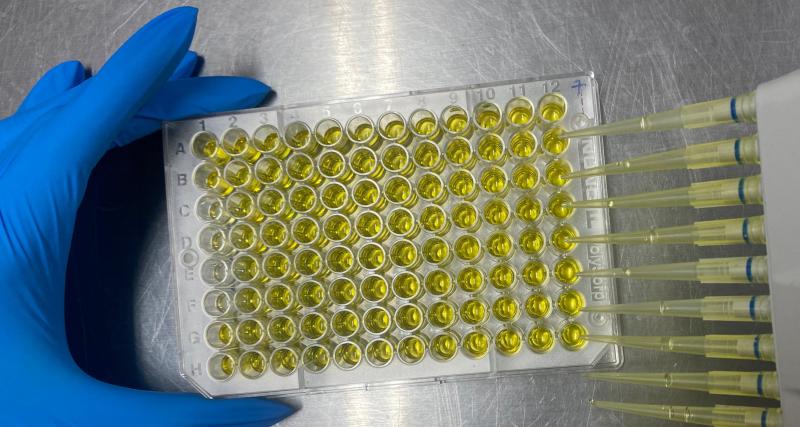 Síndrome Disgenésico y Respiratorio Porcino  PRRS ELISA