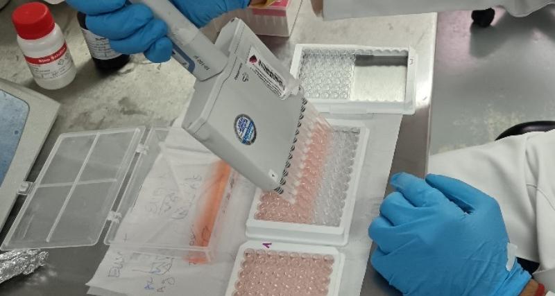 Análisis ELISA de Bursitis Infecciosa