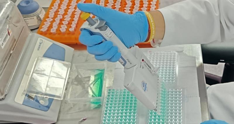 Solicitud de análisis de muestra de Newcastle por ELISA indirecto 