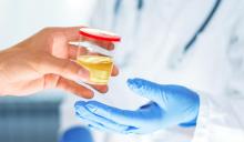 plomo en orina de 24 horas y/o sangre