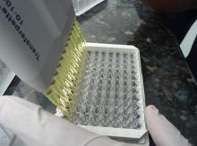 Análisis de muestra por ELISA