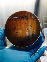 Microbiología cultivo