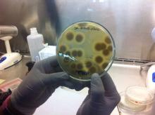 Hongos Patógenos  cultivo y tinción