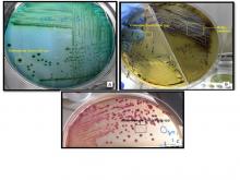 Salmonellosis  cultivo 