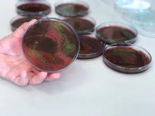 Enterobacterias cultivo