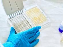 Rinotraqueítis Infecciosa Bovina ELISA