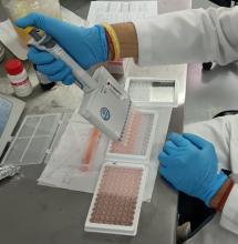 Análisis ELISA de Bursitis Infecciosa