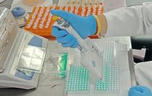 Solicitud de análisis de muestra de Newcastle por ELISA indirecto 